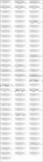 Nord-Lead-4-Waveforms.gif